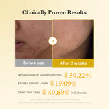 Kojic Acid Tumeric Toner Pad - Medicube