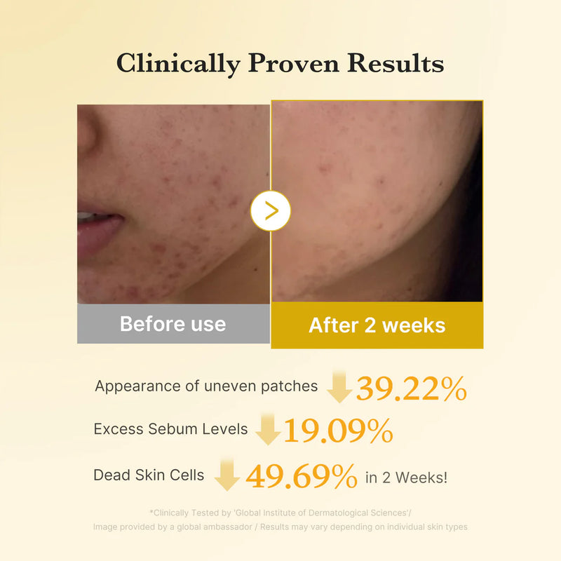 Kojic Acid Tumeric Toner Pad - Medicube