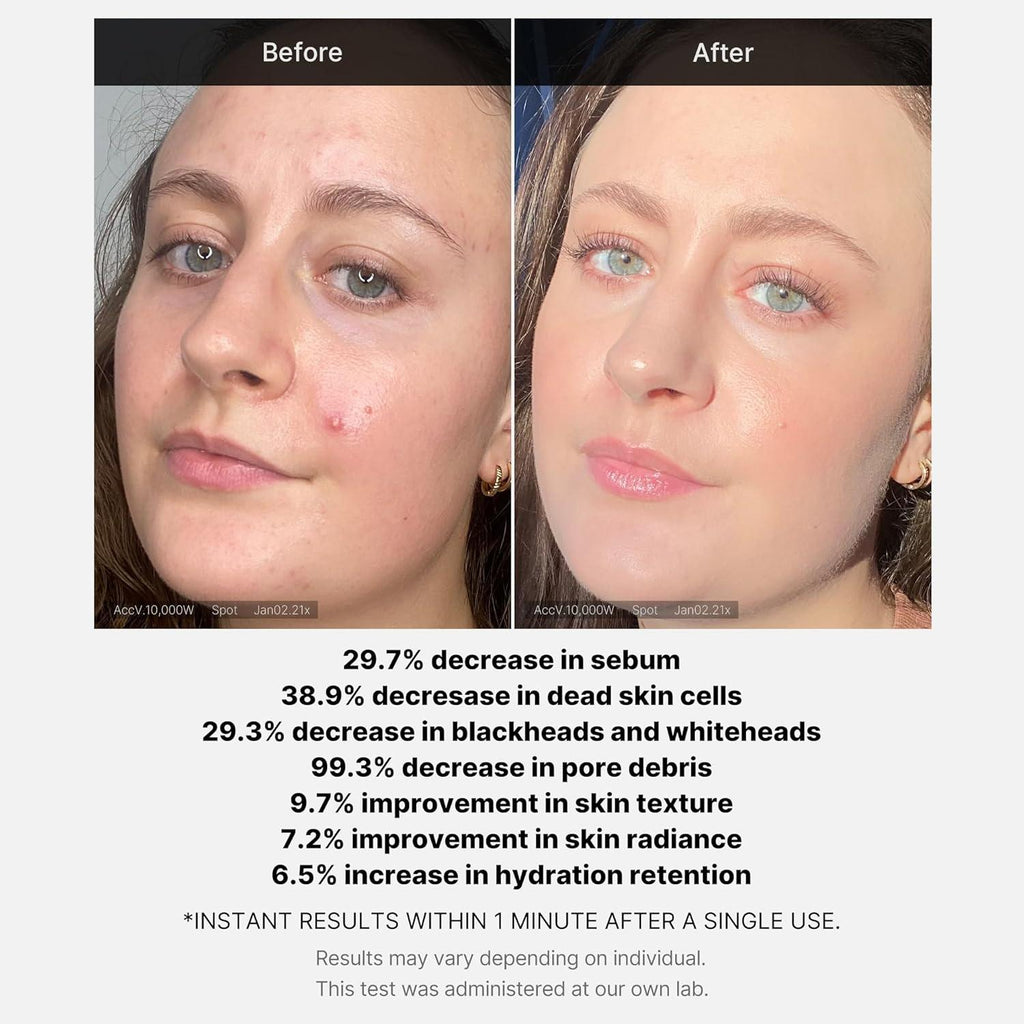 [PRÉ VENDA] Medicube 21% Acid Wash-off Exfoliant