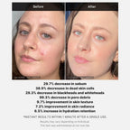 [PRÉ VENDA] Medicube 21% Acid Wash-off Exfoliant