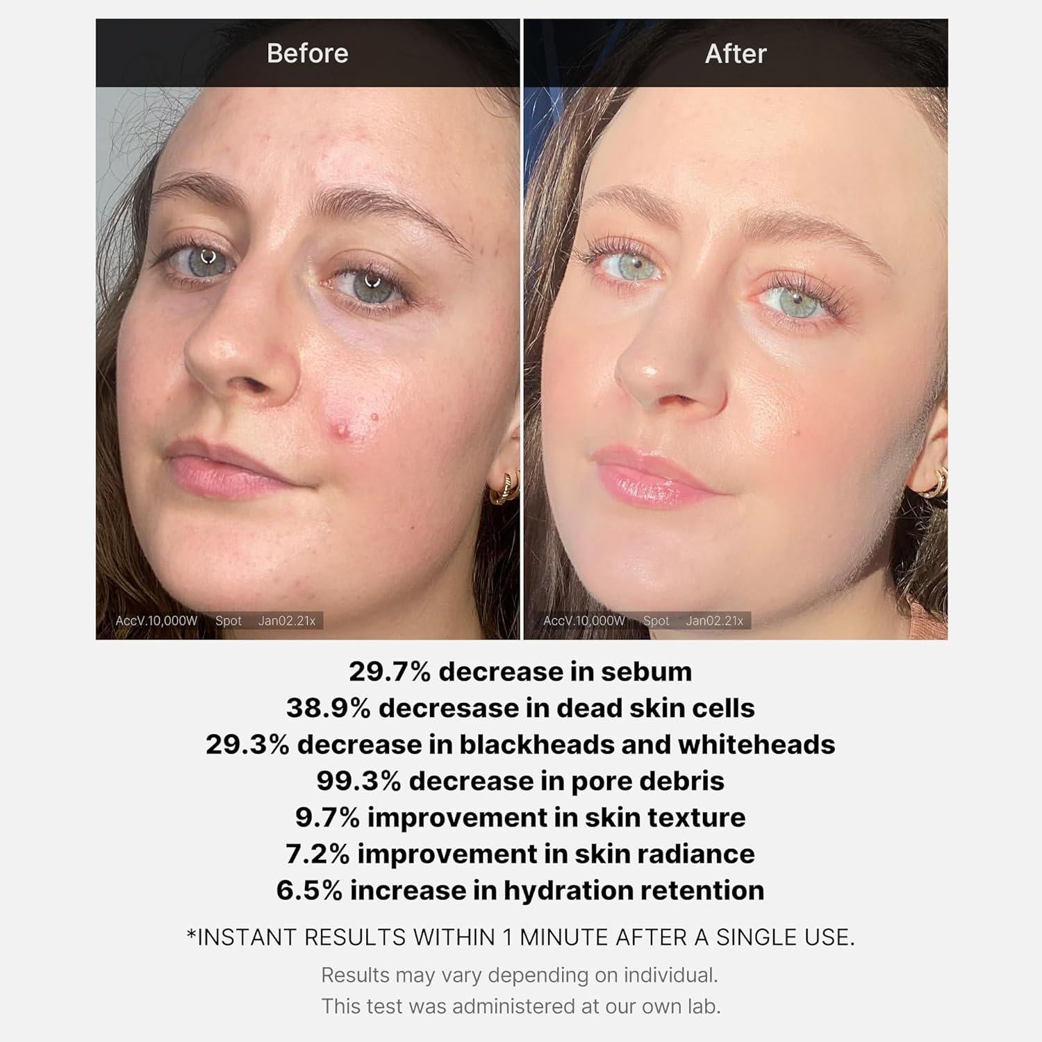 [PRÉ VENDA] Medicube 21% Acid Wash-off Exfoliant