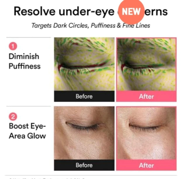 [PRÉ VENDA] PDRN Retinal Eye Patch