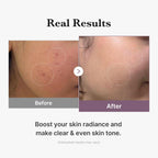 [PRÉ VENDA] Age-R Glutathione Glow Milky Toner