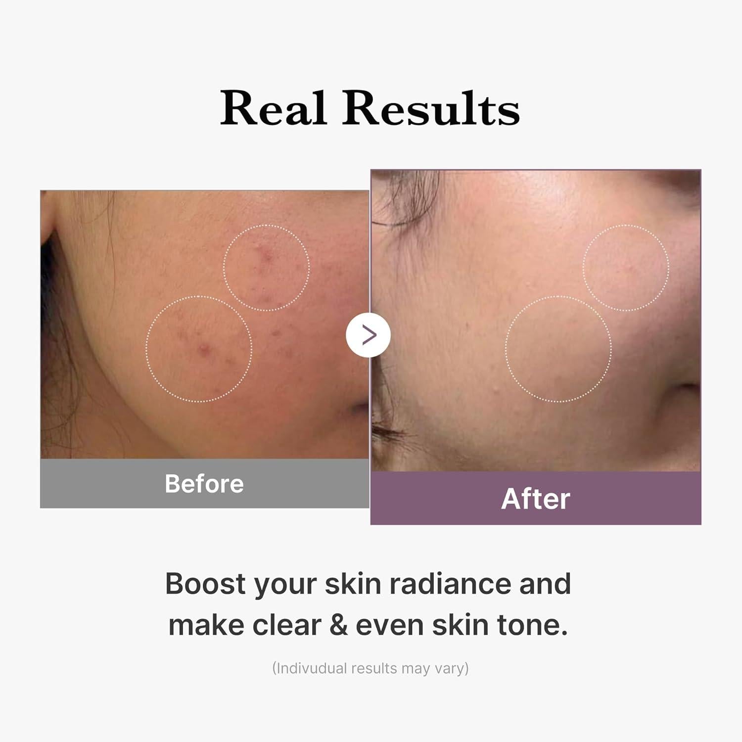 [PRÉ VENDA] Age-R Glutathione Glow Milky Toner