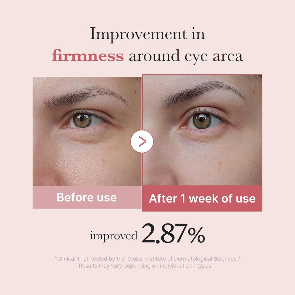 [PRÉ VENDA] PDRN Pink Peptide Eye Cream