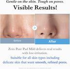 [PRÉ VENDA] Zero Pore Pad Mild