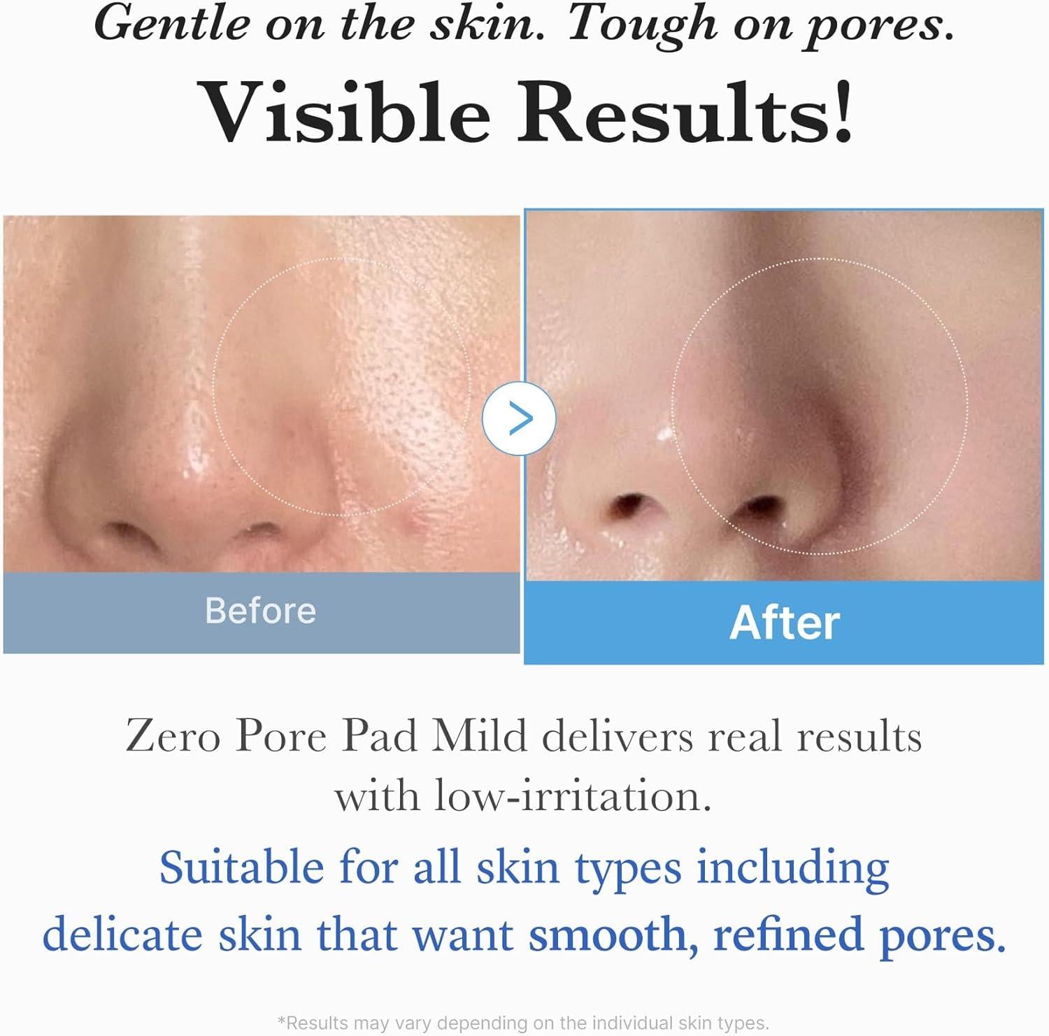 [PRÉ VENDA] Zero Pore Pad Mild
