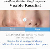 Zero Pore Pad Mild