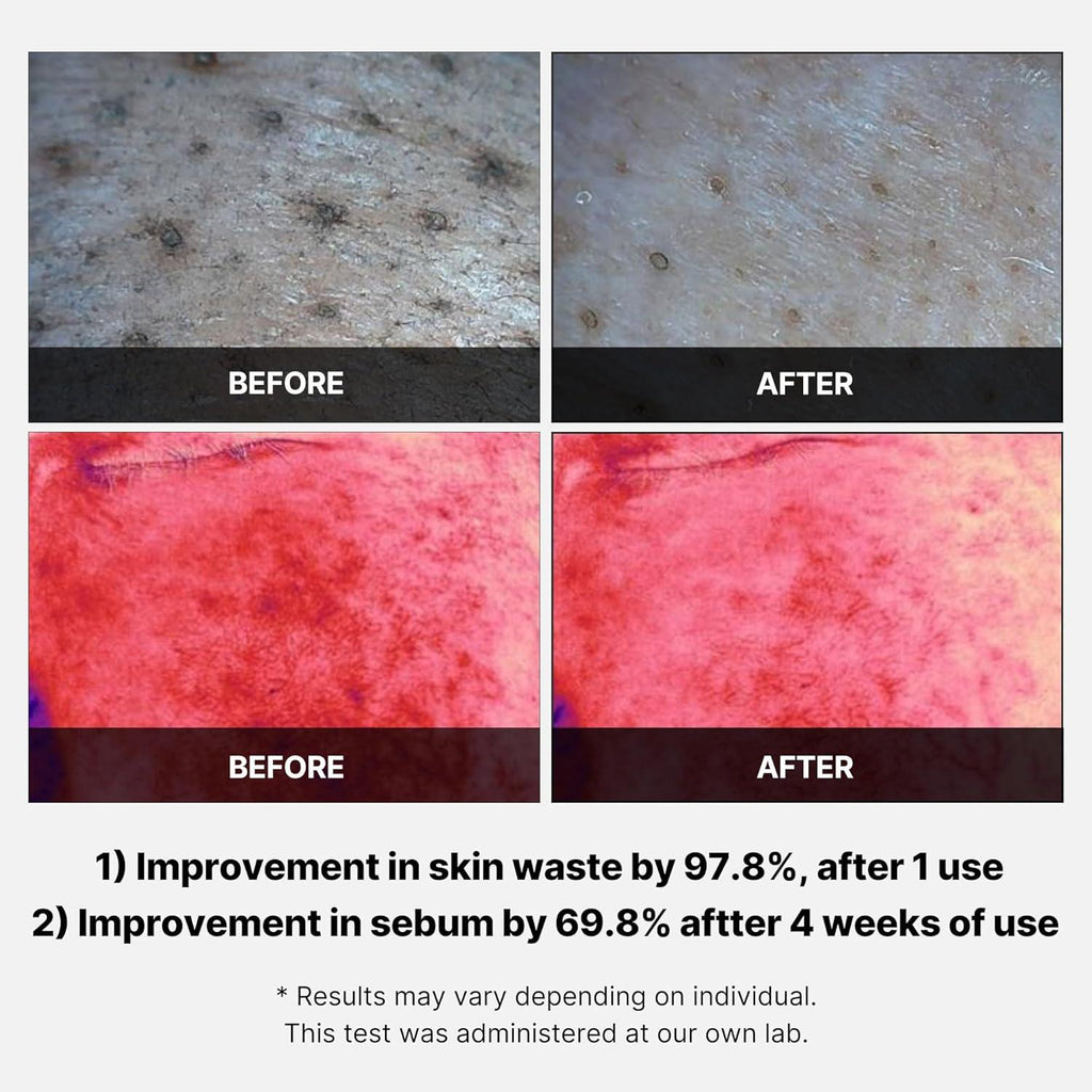 [PRÉ VENDA] Red Succinic Acid Peeling Pads