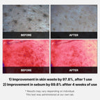 [PRÉ VENDA] Red Succinic Acid Peeling Pads