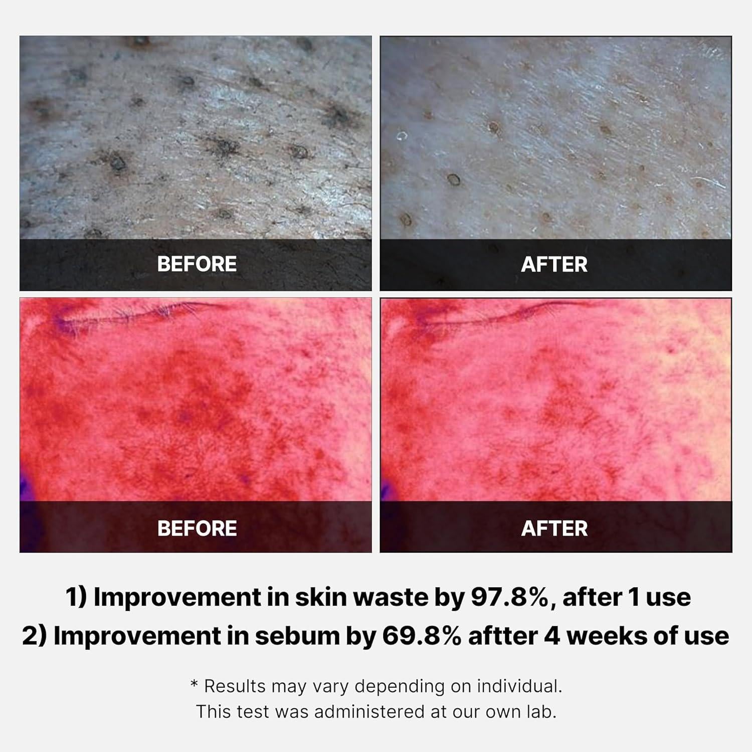 [PRÉ VENDA] Red Succinic Acid Peeling Pads