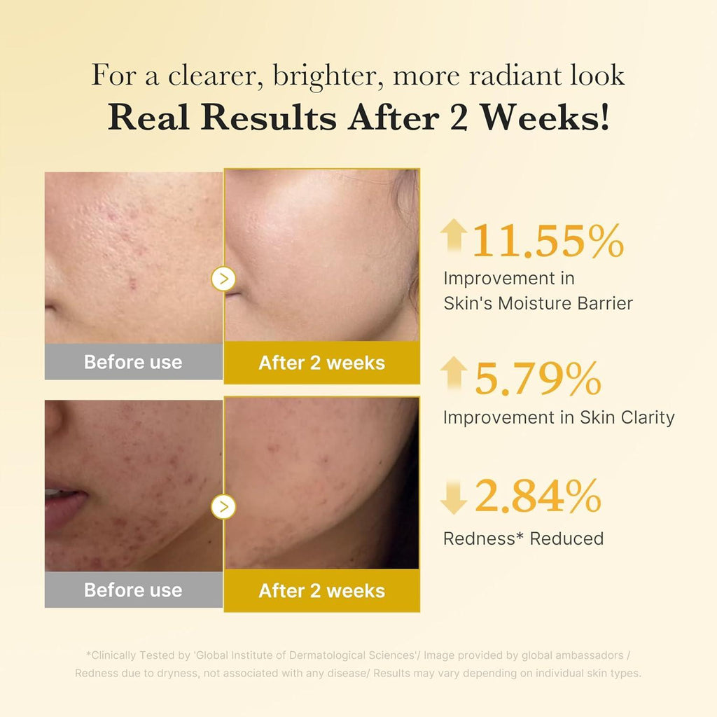 [PRÉ VENDA] Kojic Acid Turmeric Niacinamide Serum
