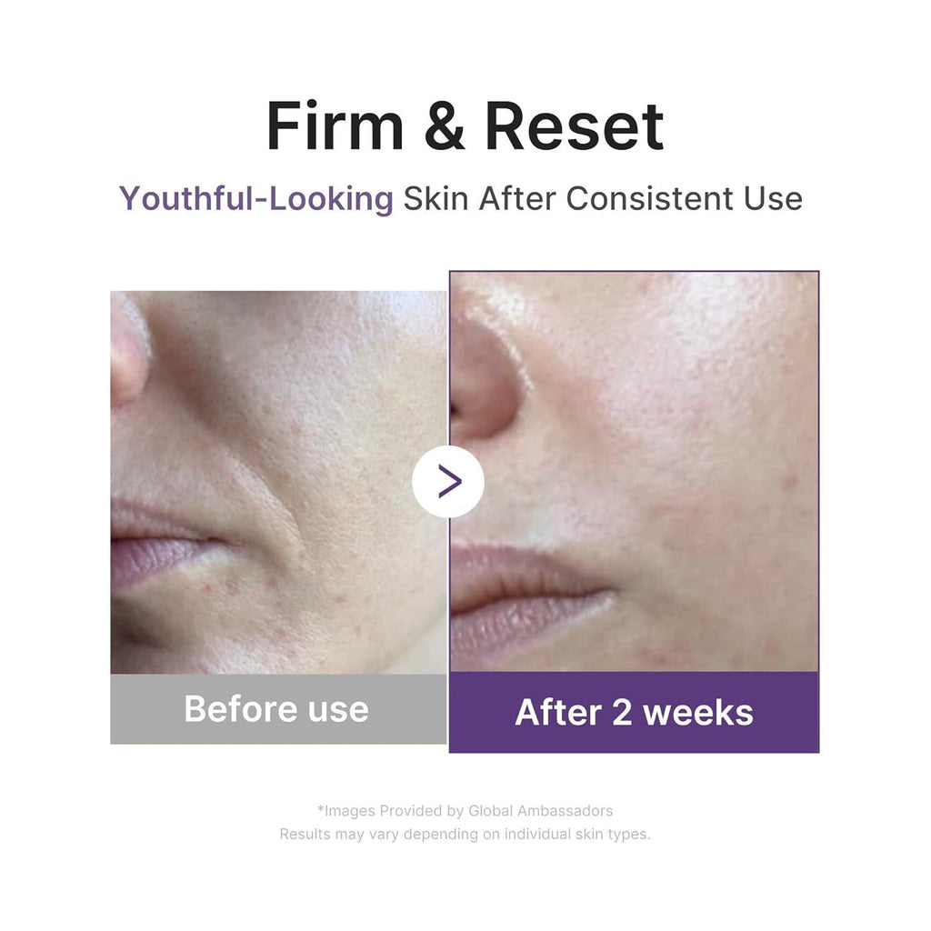 [PRÉ VENDA] Retinol Boosting Serum 1.9%