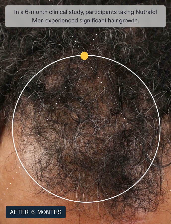 [PRÉ VENDA] Suplemento Capilar para Homens - Hair Growth Supplement