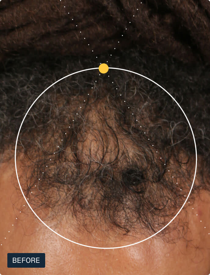 [PRÉ VENDA] Suplemento Capilar para Homens - Hair Growth Supplement