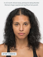 [PRÉ VENDA] Hair Growth Nutraceutical - Women's Vegan
