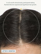 [PRÉ VENDA] Suplemento Capilar - Hair Growth Nutraceutical