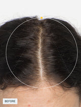 [PRÉ VENDA] Suplemento Capilar - Hair Growth Nutraceutical